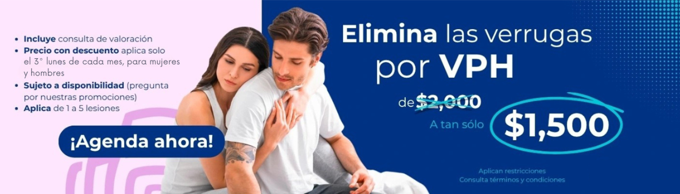 Consulta VPH