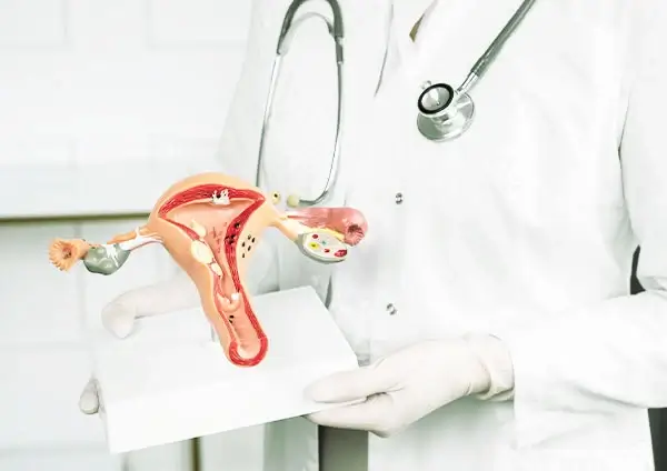 Cono Cervical