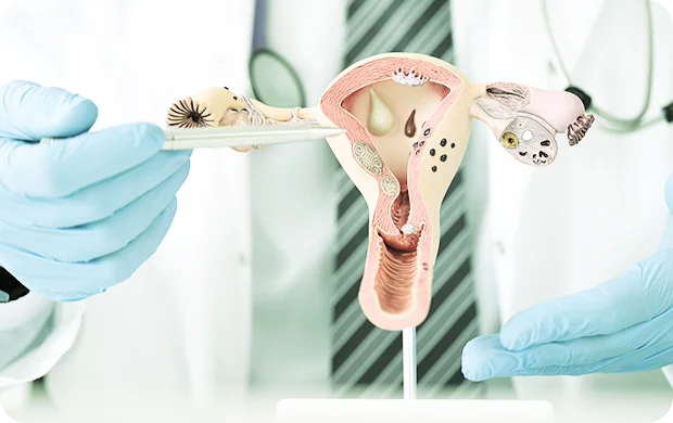 Endometrio